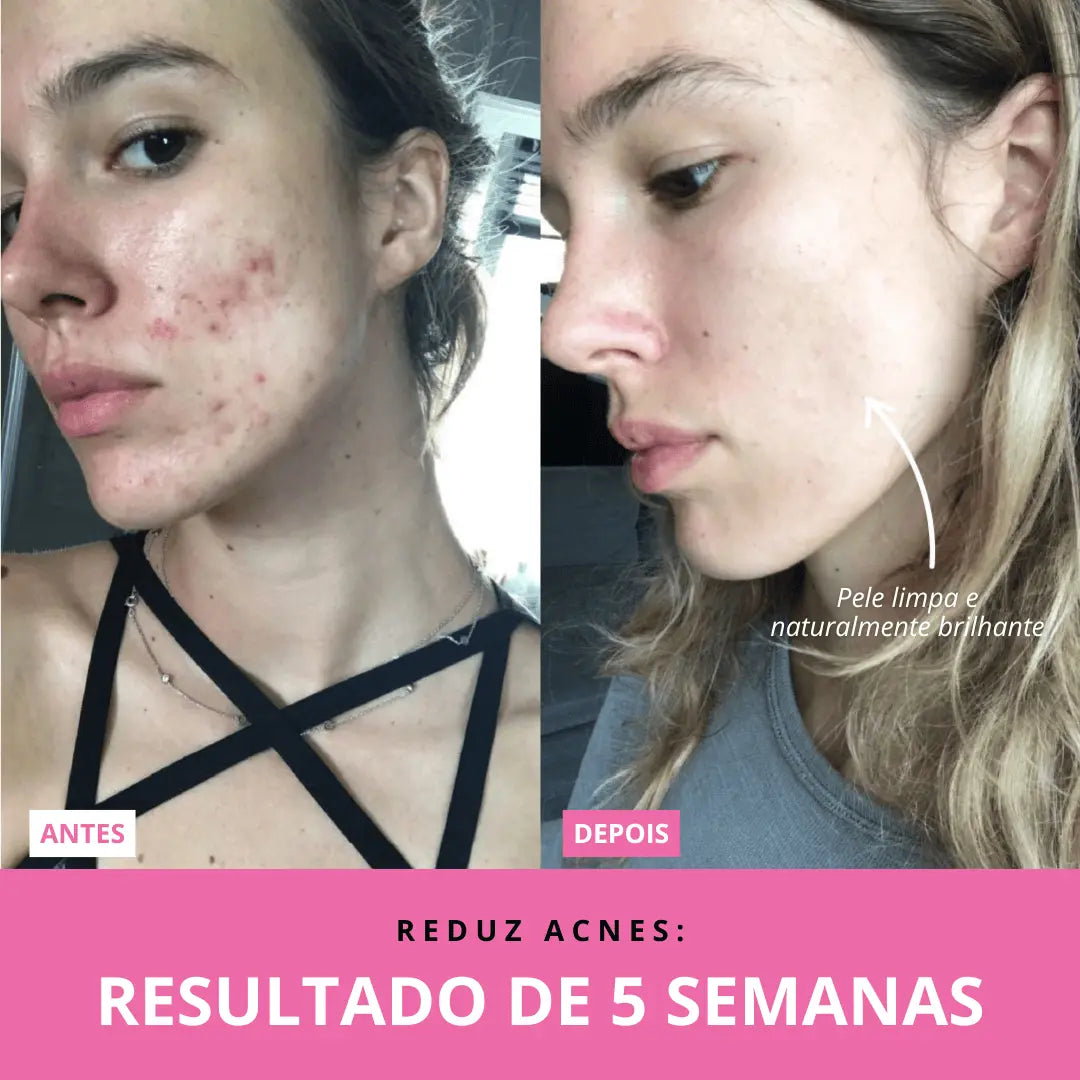 Aurea Glow™ | Rejuvenescedor Facial LED + Sérum GRÁTIS